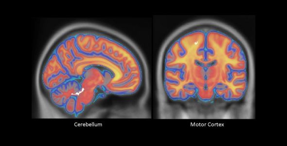 White Matter in the Brain