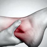 Martial Arts Injuries