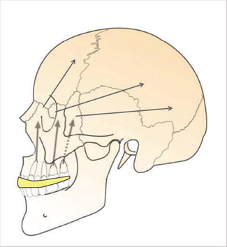 Skull Image showing force of a strike absorbed by mouthguards.